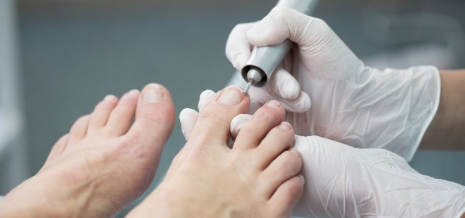 Nagu sēnīte – neārstēta pati nepazudīs, dermatologs atspēko populārākos aizspriedumus